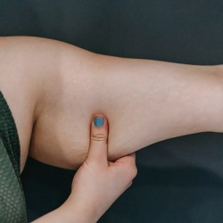 Hábitos que Emagrecem: Efeito sanfona, você já passou por isso?